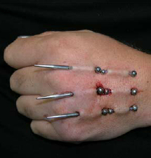 surface-piercing