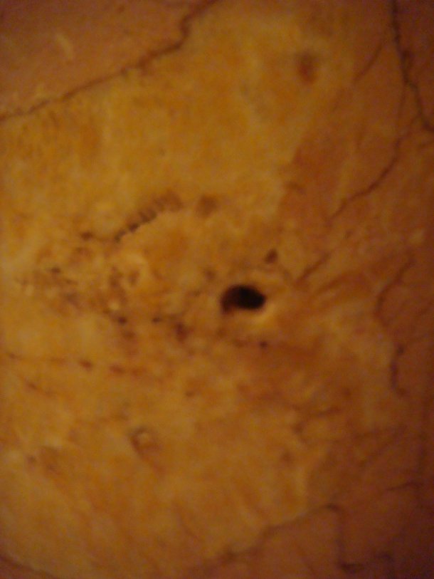 bullet-holes-huey-long-assassination