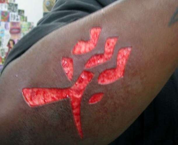 flesh removal tattoo