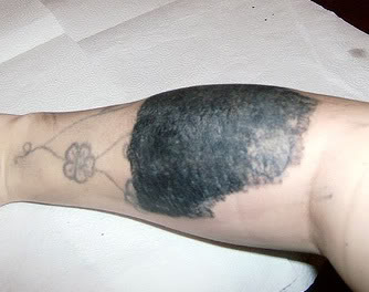 One horrendous tattoo