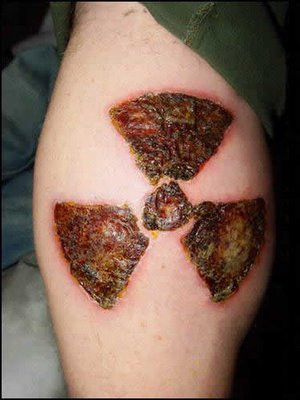skin burning tattoos