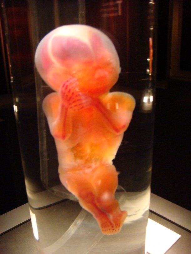 bodies-revealed-fetus